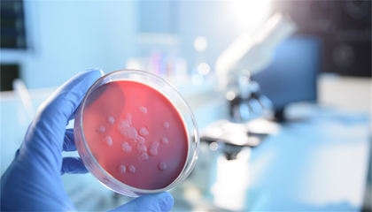 蘭州獸醫(yī)研究所布魯氏桿菌感染65人呈陽性,市疾控中心:已展開調(diào)查